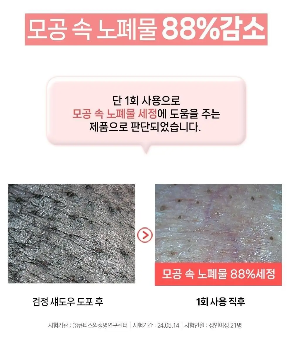 [여드름기능성/약알칼리성] 아토뮤 아크리스 폼클렌저 120ml 상세페이지 20